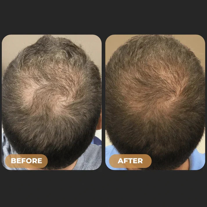 SPARTAN™ - Root Activator Spray