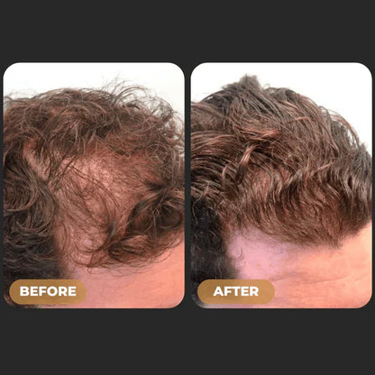 SPARTAN™ - Root Activator Spray