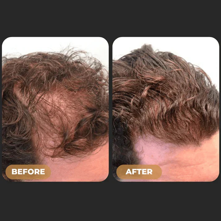 Spartan™ -  Root Activator Shampoo